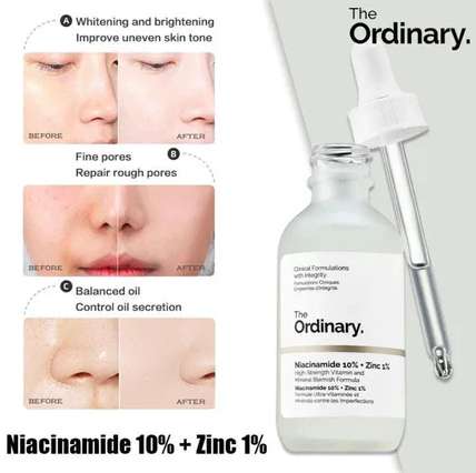 he Ordinary Niacinamide Serum 10% + Zinc 1% Supersize Serum [Buy 1 Get 1 Free] | Best Quality Serum 30ML