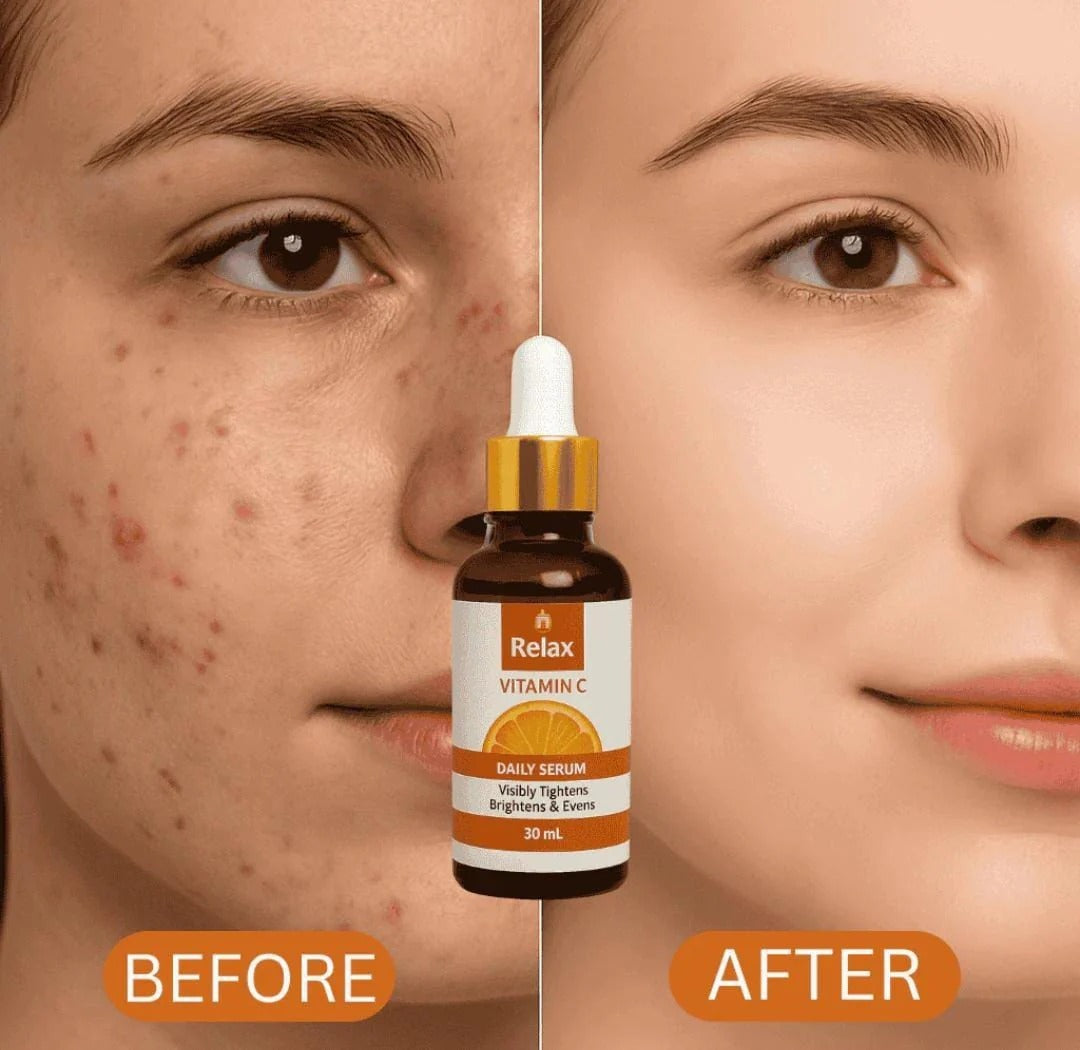 Relax Vitamin C Daily Serum 30ml – Skin Brightening, Dark Spot Reduction & Anti-Aging Glow Booster